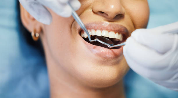 Best Emergency Tooth Extraction in Evans, GA