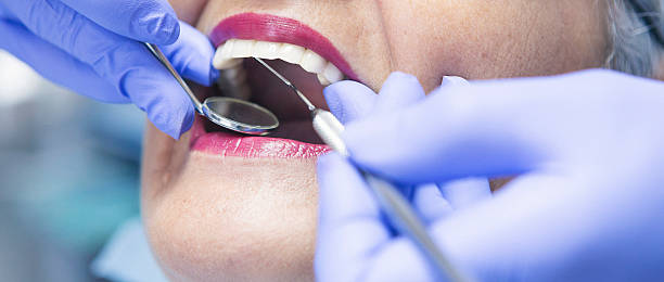 Best After-Hours Dental Trauma Care in Evans, GA